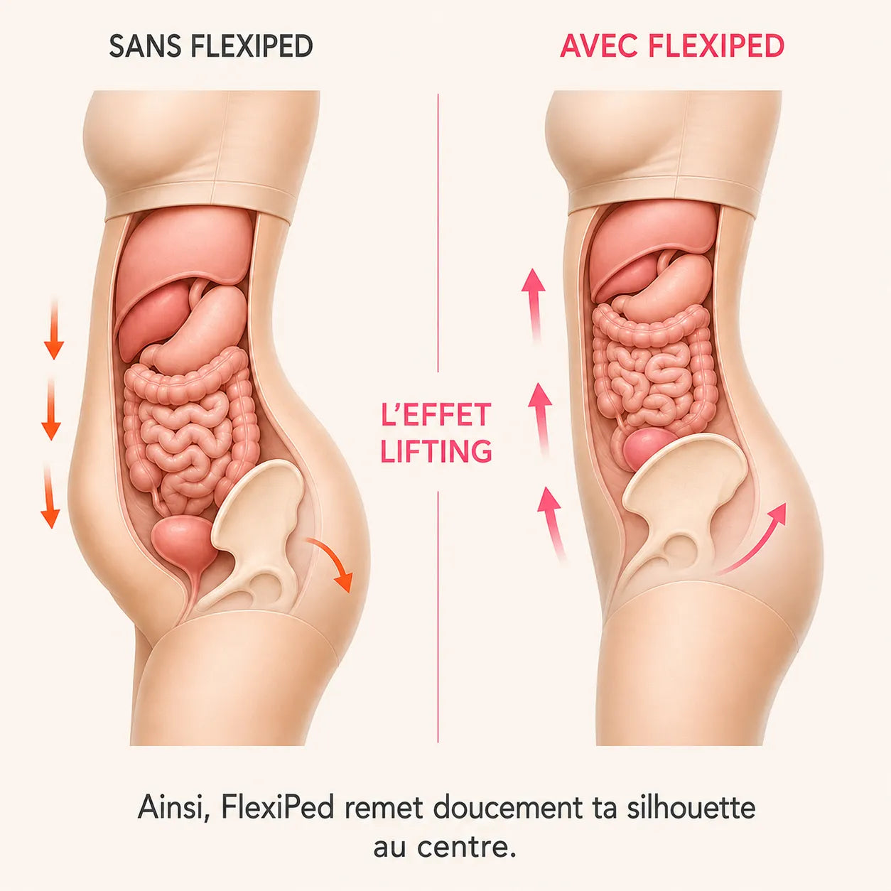 FlexiPed